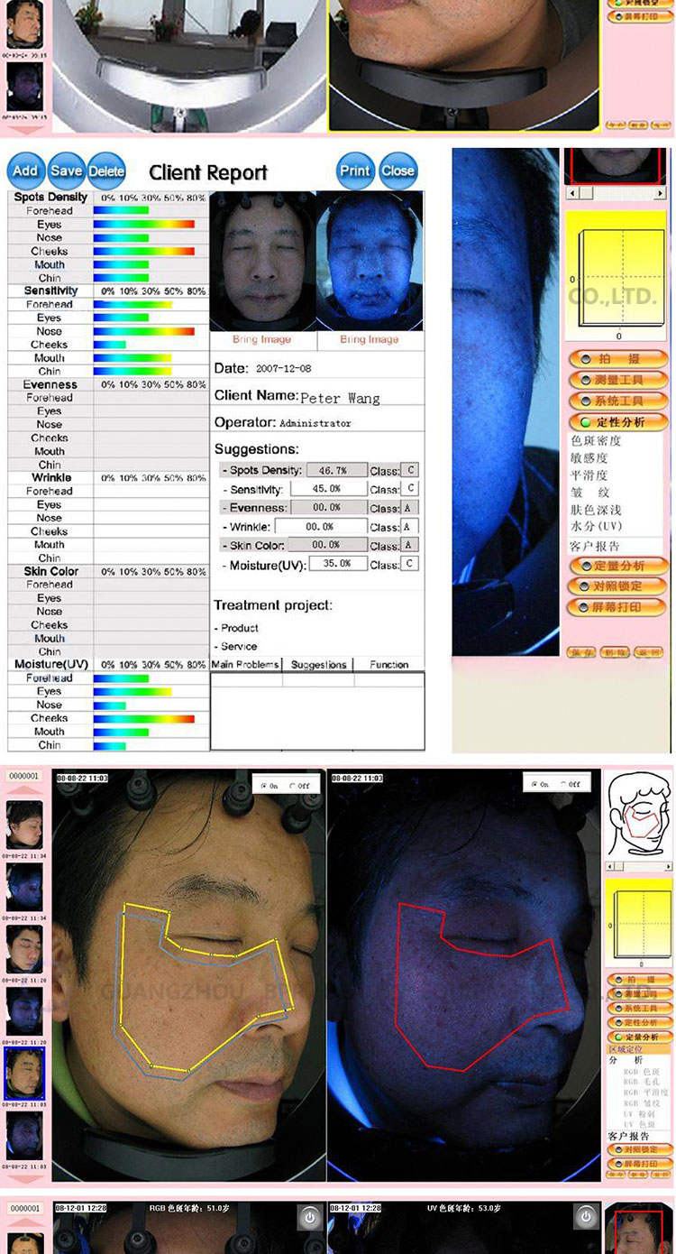 Skin Analysis Machine Description 7