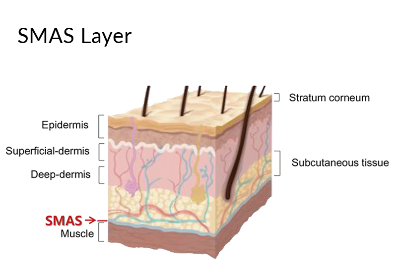 Superficial muscular aponeurotic system (SMAS)