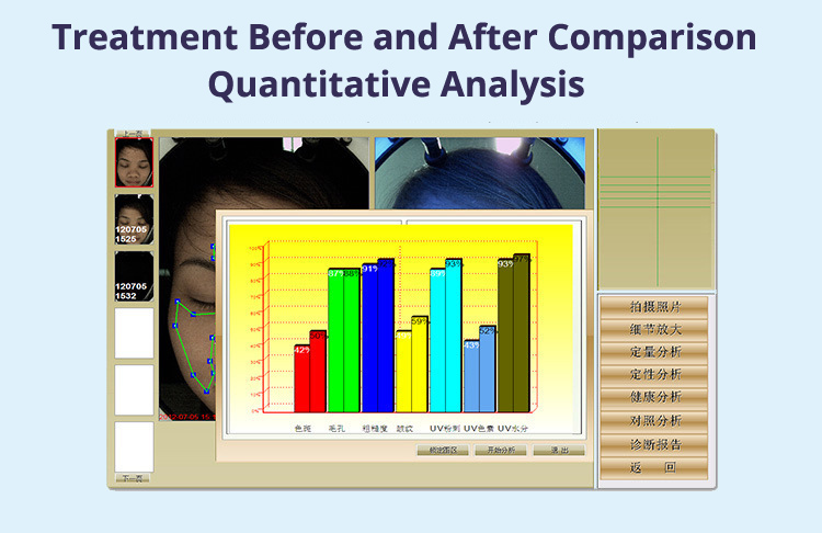 Skin Analysis Machine Comparison