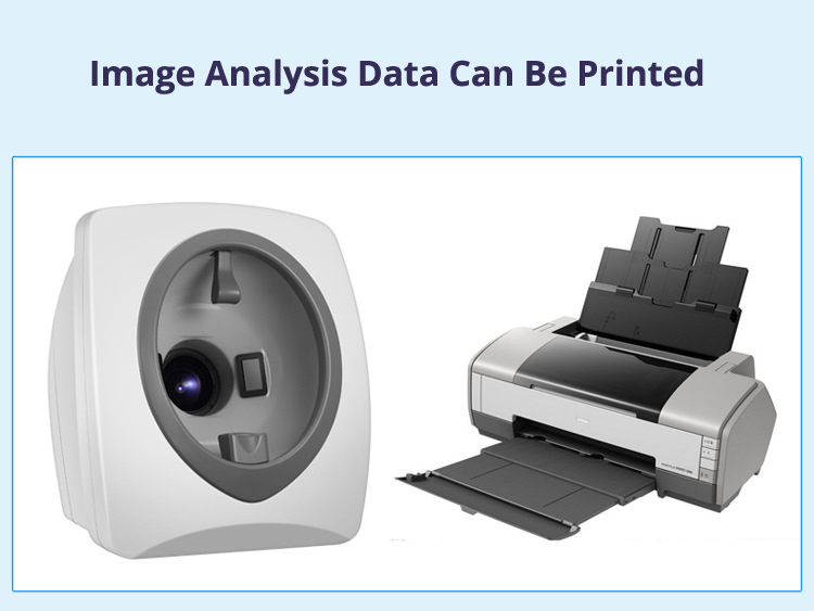 Skin Analysis Machine Data Print