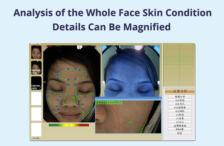 Skin Analysis Machine Details Magnified