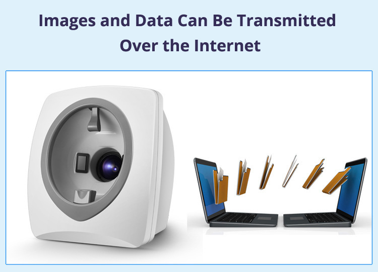 Skin Analysis Machine Internet Transfer Data